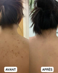 Helvano | Peeling-Waschlappen für die Dusche