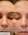 Helvano | Anti-Aging Collagen-Stick mit PDRN fürs Gesicht