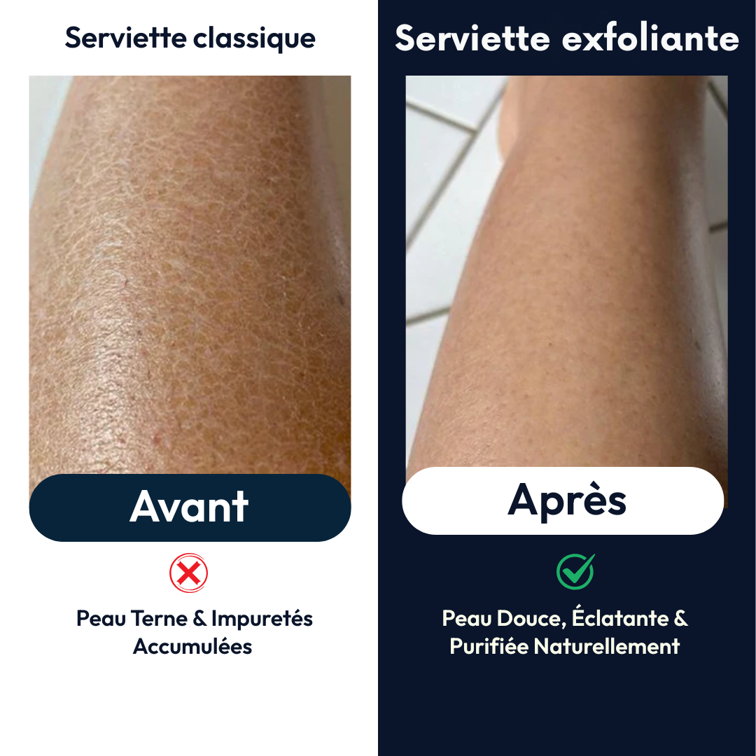 Helvano | Sanftes Peeling-Handtuch