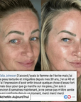 Helvano | Anti-Aging Collagen-Stick mit PDRN fürs Gesicht
