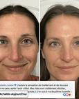 Helvano | Anti-Aging Collagen-Stick mit PDRN fürs Gesicht