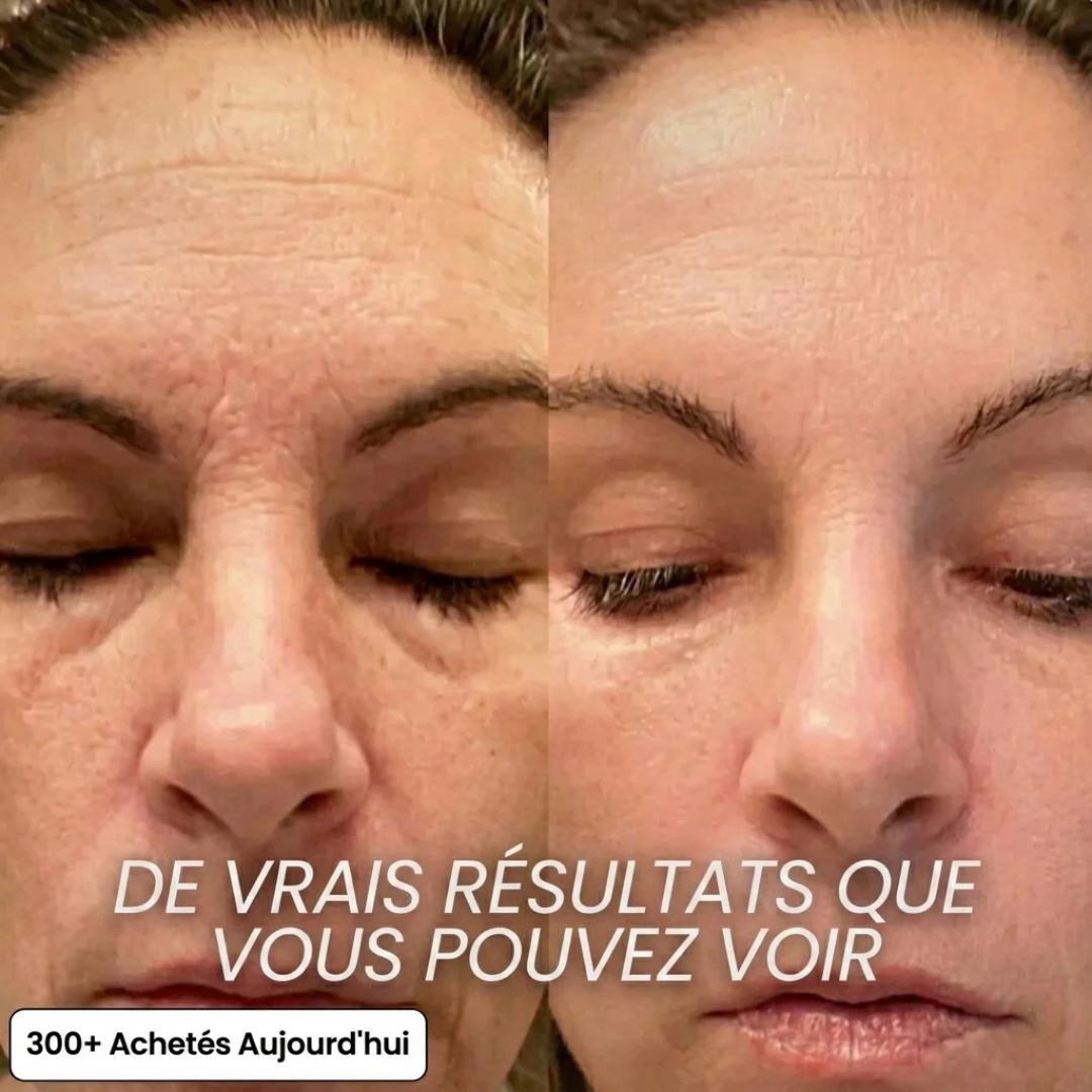 Helvano | Anti-Aging Collagen-Stick mit PDRN fürs Gesicht