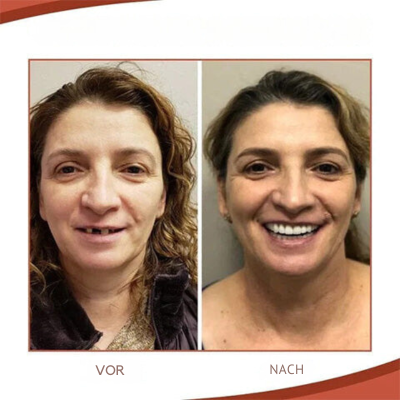 Helvano | Herausnehmbare Zahnprothese mit Naturzähnen