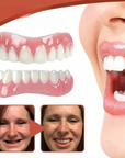 Helvano | Herausnehmbare Zahnprothese mit Naturzähnen